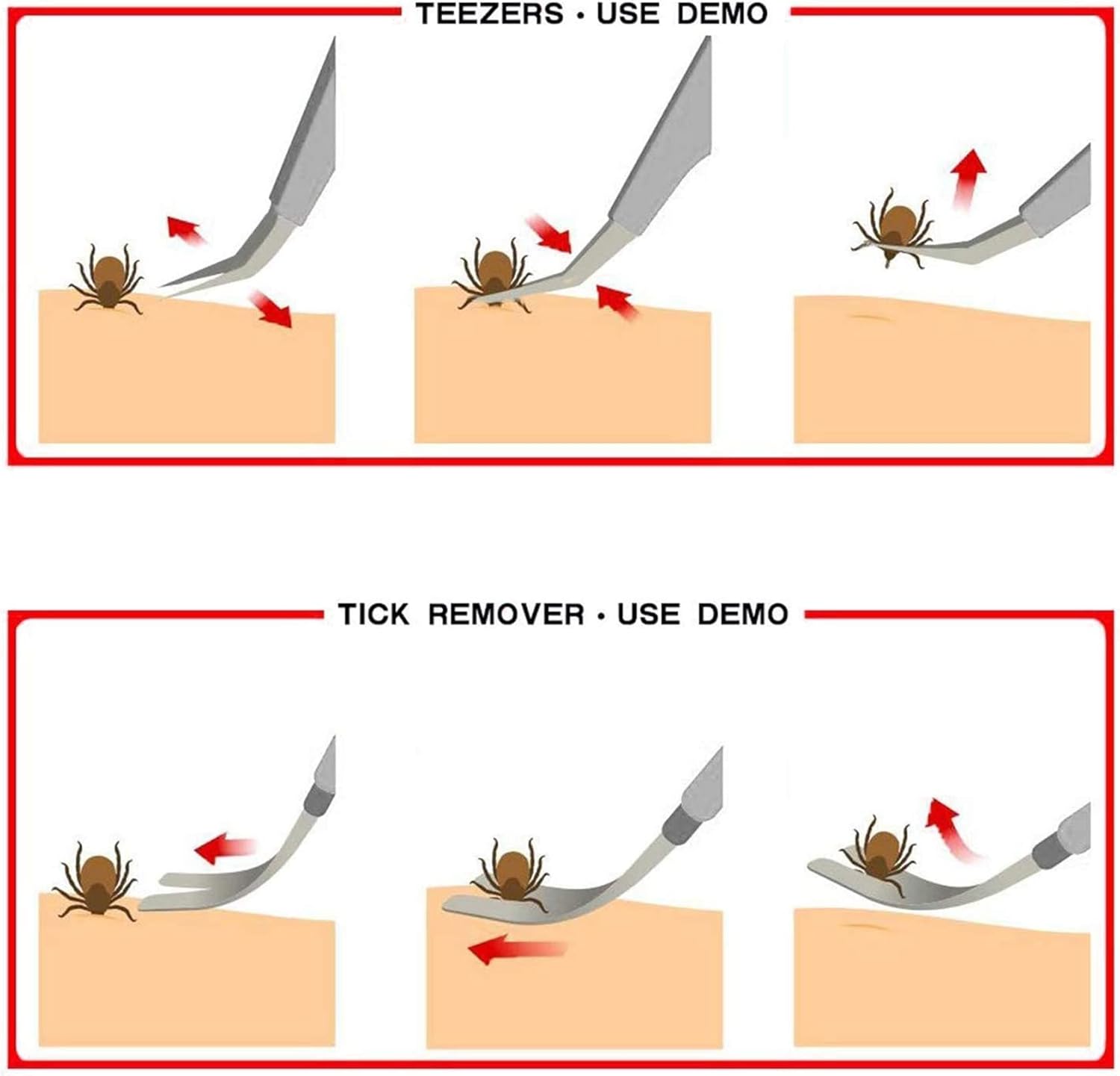 🐾 2-in-1 Profi Zeckenzange Edelstahl mit Lederetui – Zeckenentferner für Mensch & Tier 🐜