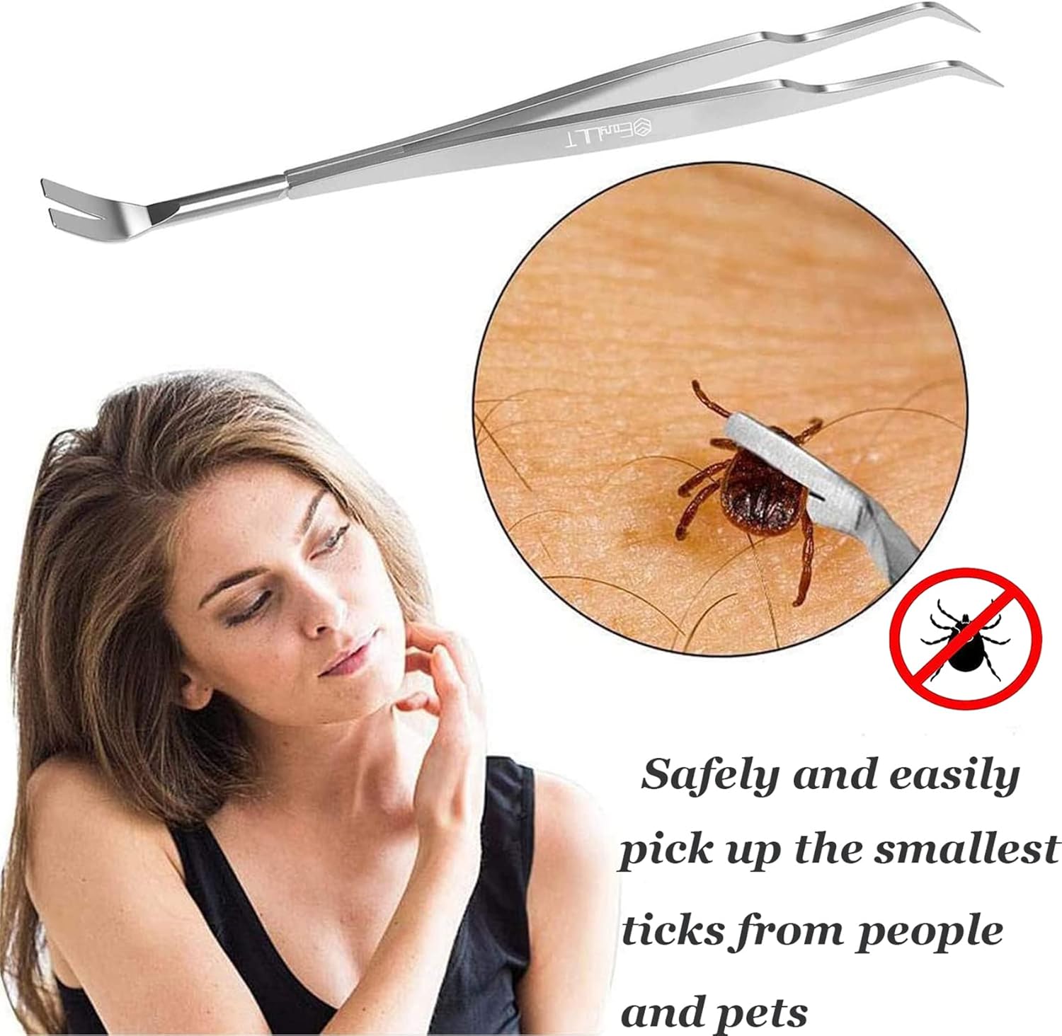 🐾 2-in-1 Profi Zeckenzange Edelstahl mit Lederetui – Zeckenentferner für Mensch & Tier 🐜